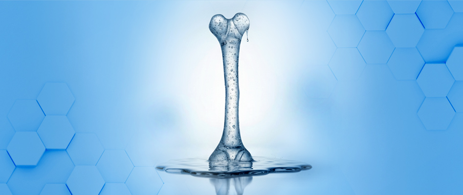 Osteoporoz (Kemik Erimesi)