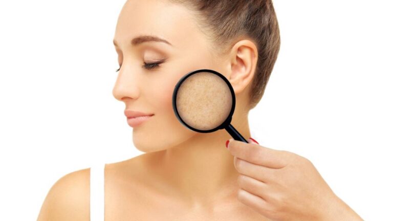 What Causes Skin Spots and How Do They Pass?