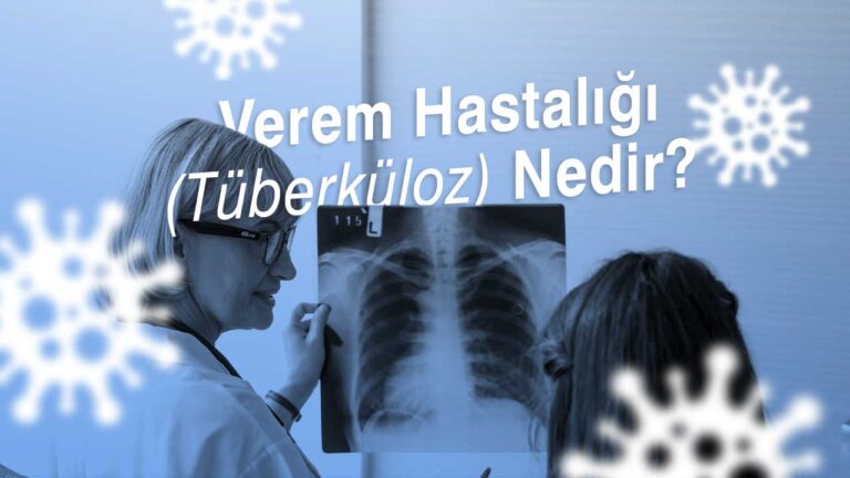 Verem Hastalığı (Tüberküloz) Nedir?